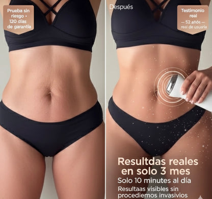 SkinSculpt Reductor de Grasa & Reafirmante [Define en Semanas]